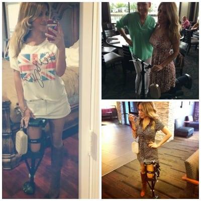 Kavita Channe on her prosthetic devices