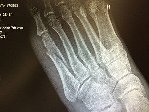 Kavita Channe's X-Ray